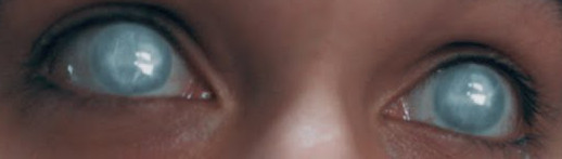 Pair of clouded eyes